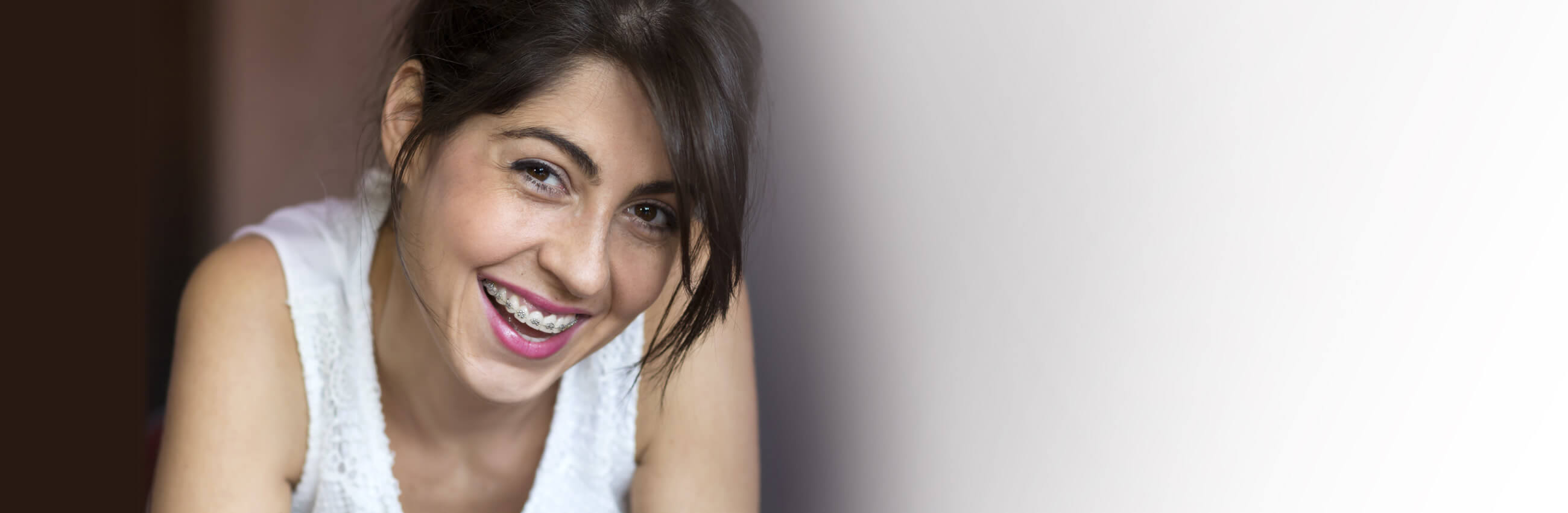 Fixed Braces at BDS Dental Golders Green